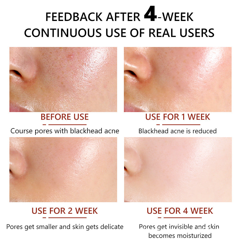 Vibrant Glamour Pore Minimizing Serum 30ml | Salicylic Acid + Hyaluronic Acid