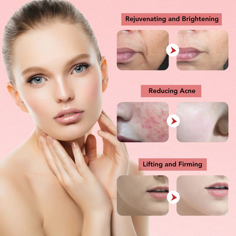 7-in-1 RF & EMS Microcurrent Lifting Device – LED Vibration Anti-Ageing Facial Beauty Wand