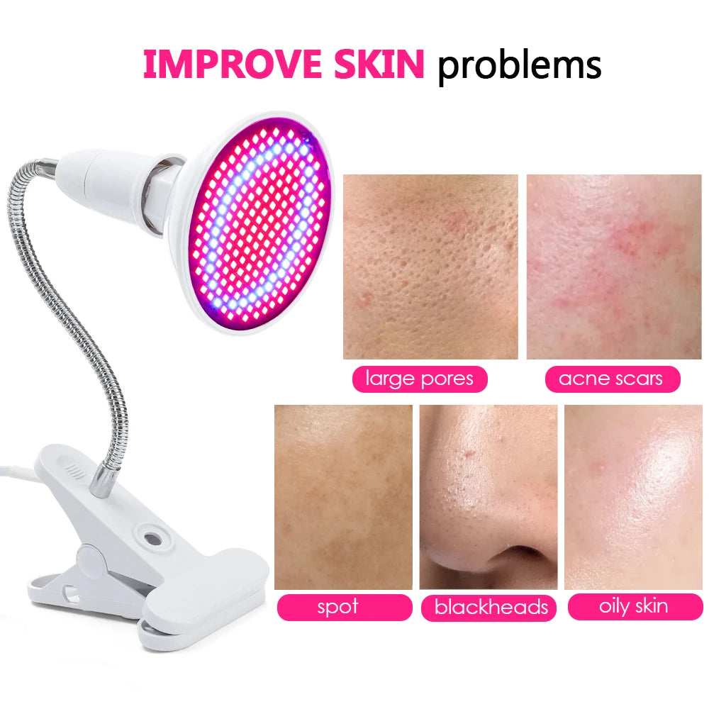 LED Red Light Photon Therapy Face Mask – Acne Treatment, Wrinkle Removal & Skin Rejuvenation