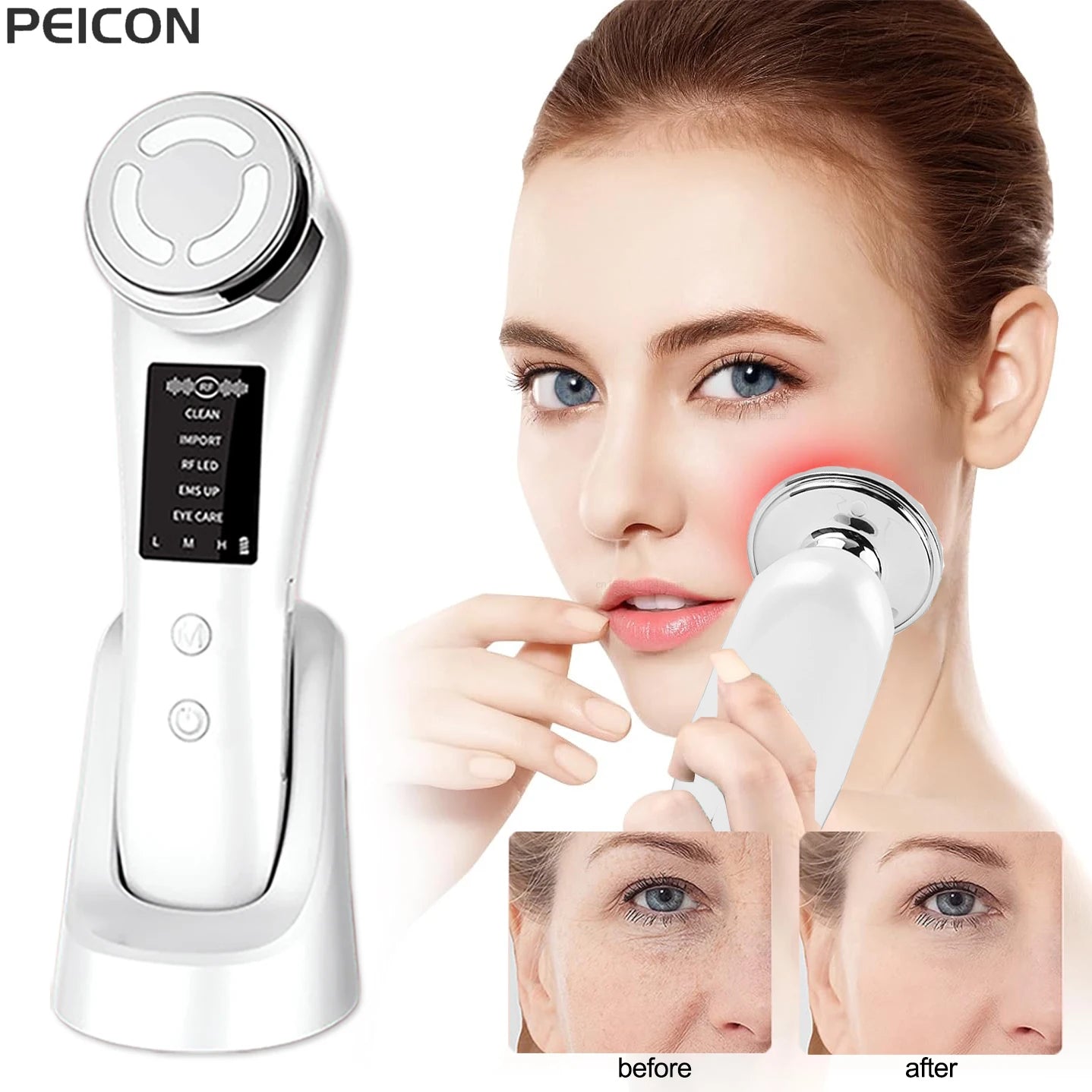 EMS Microcurrent Facial Massager – Anti-Ageing Face Lifting & Skin Tightening Device