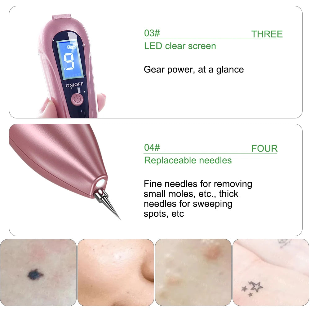 Plasma Pen Skin Tag & Wart Remover – LCD 9-Level Fibroblast Beauty Device