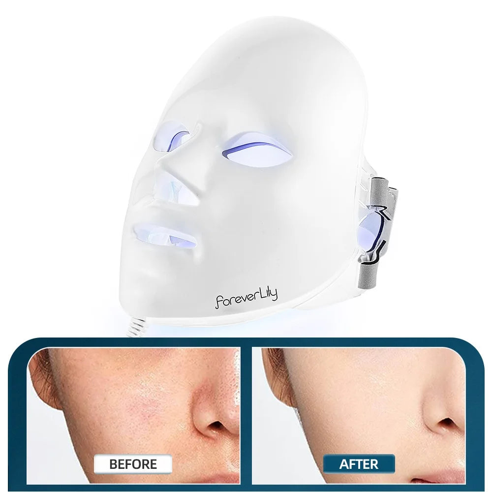 7-Colour LED Facial Mask – Phototherapy for Acne, Whitening & Anti-Wrinkle Skin Care