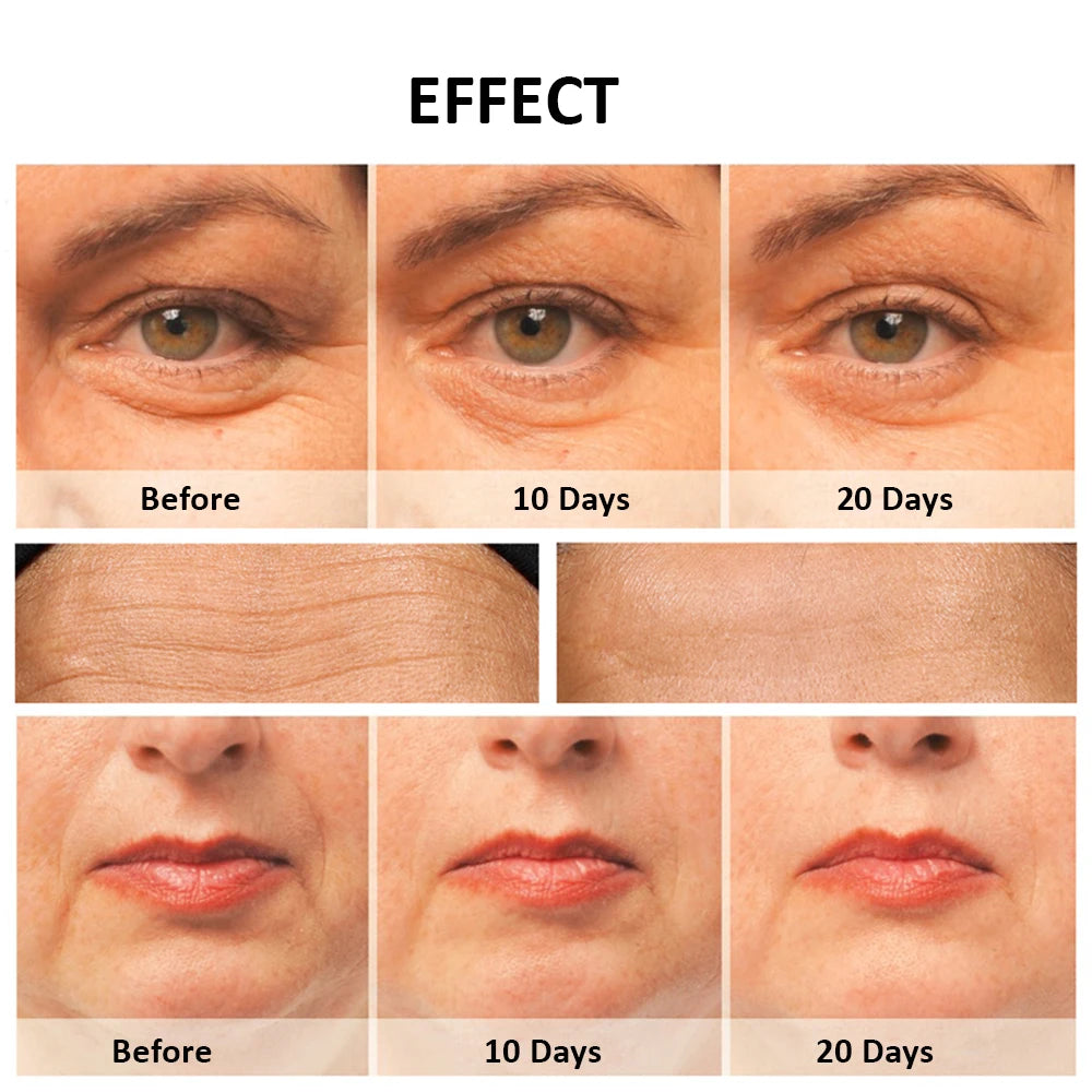 EMS Microcurrent Facial Massager – Anti-Ageing Face Lifting & Skin Tightening Device