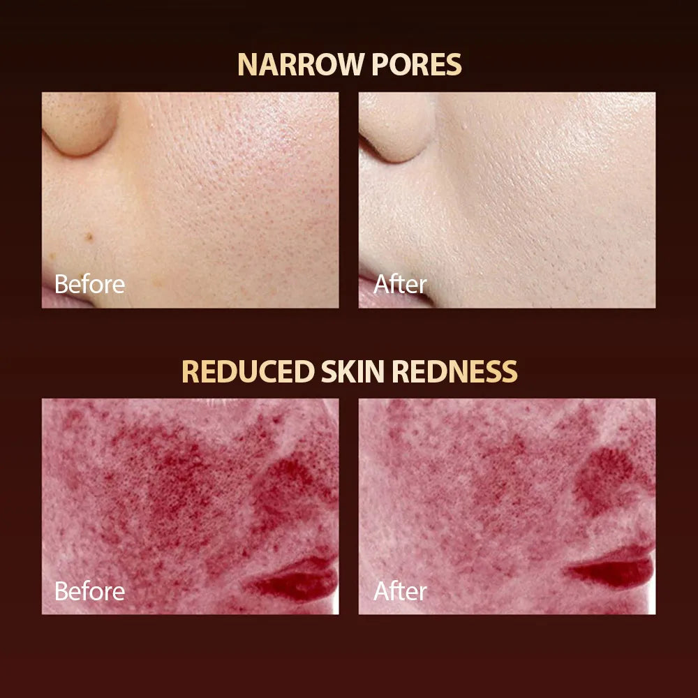 7-Colour LED Facial Mask – Silicone Photon Therapy for Pore Tightening, Whitening & Skin Repair